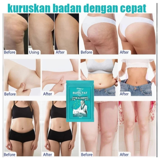 KOYO SLIMMING PATCH KOYO PELANGSING MENGECILAKAN PAHA TANGAN LENGAN PERUT BUNCIT AMPUH MENGHILANGKAN LEMAK DI TUBUH 1 PACK ISI 12 PCS - Gambar 6