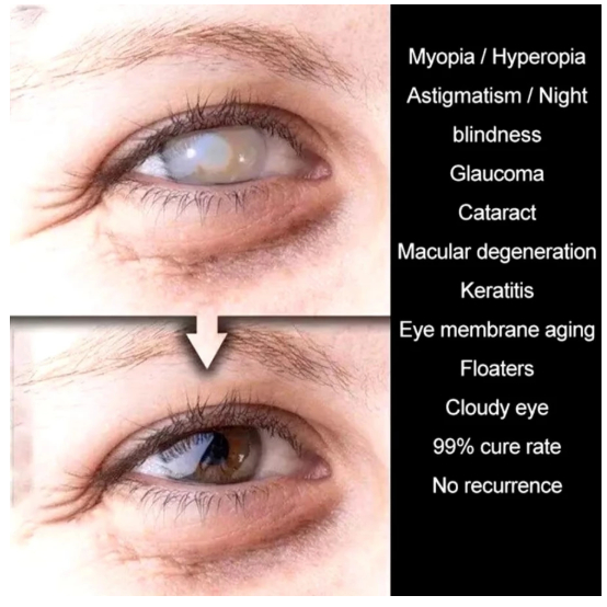 YEHUANGSU OBAT MATA TETES ORIGINAL MENGATASI MATA GATAL MATA MERAH MATA BERAIR MATA MINUS PENGLIHATAN BURAM 13ML - Gambar 5