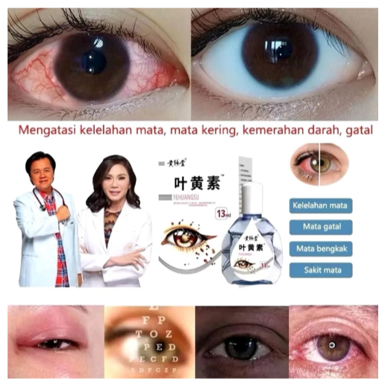 YEHUANGSU OBAT MATA TETES ORIGINAL MENGATASI MATA GATAL MATA MERAH MATA BERAIR MATA MINUS PENGLIHATAN BURAM 13ML - Gambar 7