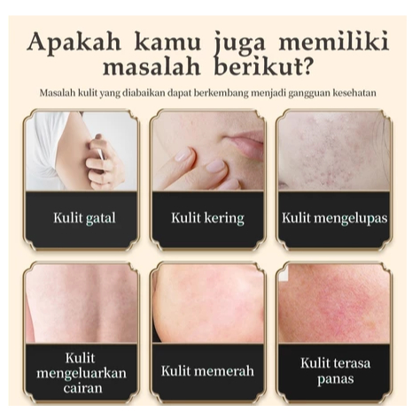 CREAM HERBAL DR.YUTITAN SKIN SOOTHING CREAM PEREDA IRITASI GATAL GATAL ALERI KULIT MERAH DAN UNTUK AREA SENSITIF - Gambar 7